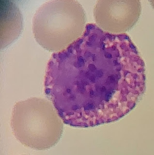 A purple and white cell

Description automatically generated