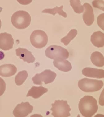 A close-up of a microscope

Description automatically generated